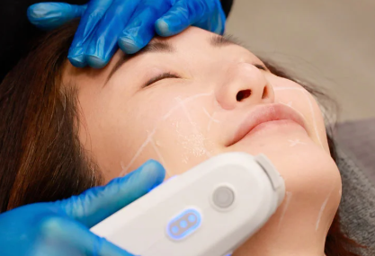 Is Ultherapy Right for You? A Practical Guide to Candidacy